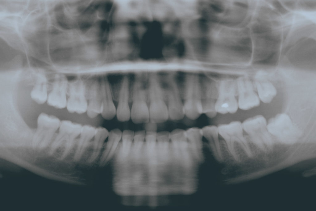 Oral pathology x-ray