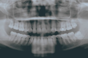 Oral pathology x-ray